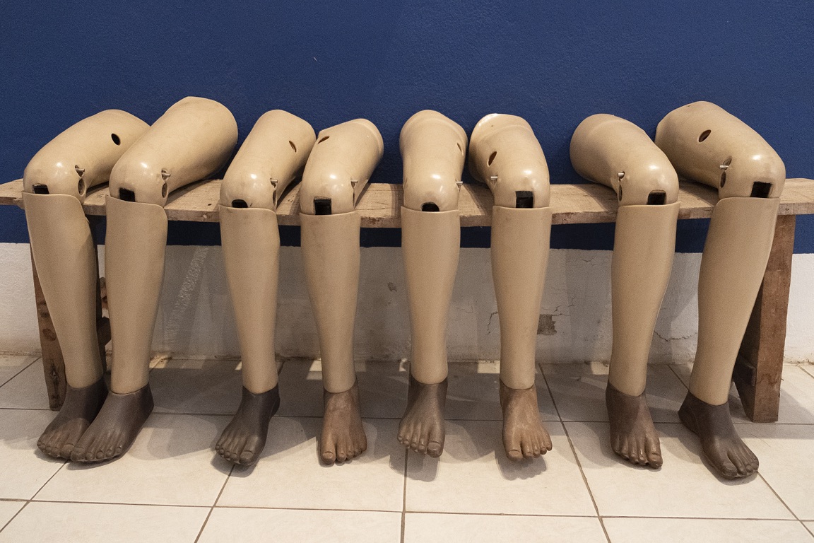 Vientian, COPE museum of landmine victims